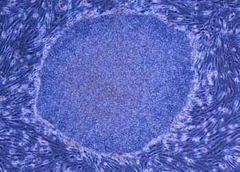 ‘Nature’ reporta avances médicos contra el Parkinson en Japón