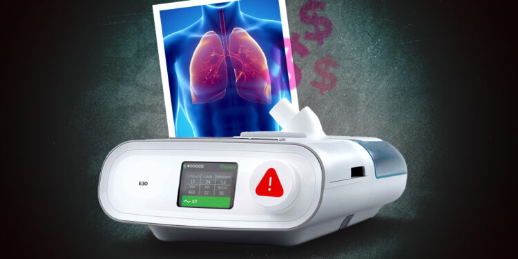 MCCI denuncia compra de ventiladores defectuosos en pandemia por Covid-19