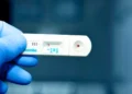 Estiman que 128,000 personas viven con VIH sin diagnóstico en México