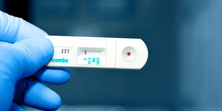 Estiman que 128,000 personas viven con VIH sin diagnóstico en México