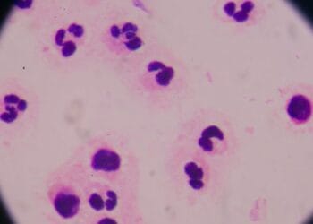 Jalisco confirma dos casos importados de ciclosporiasis