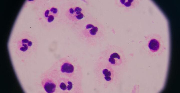 Jalisco confirma dos casos importados de ciclosporiasis